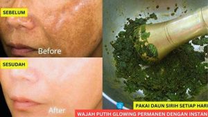 Manfaat Daun Sirih untuk Wajah